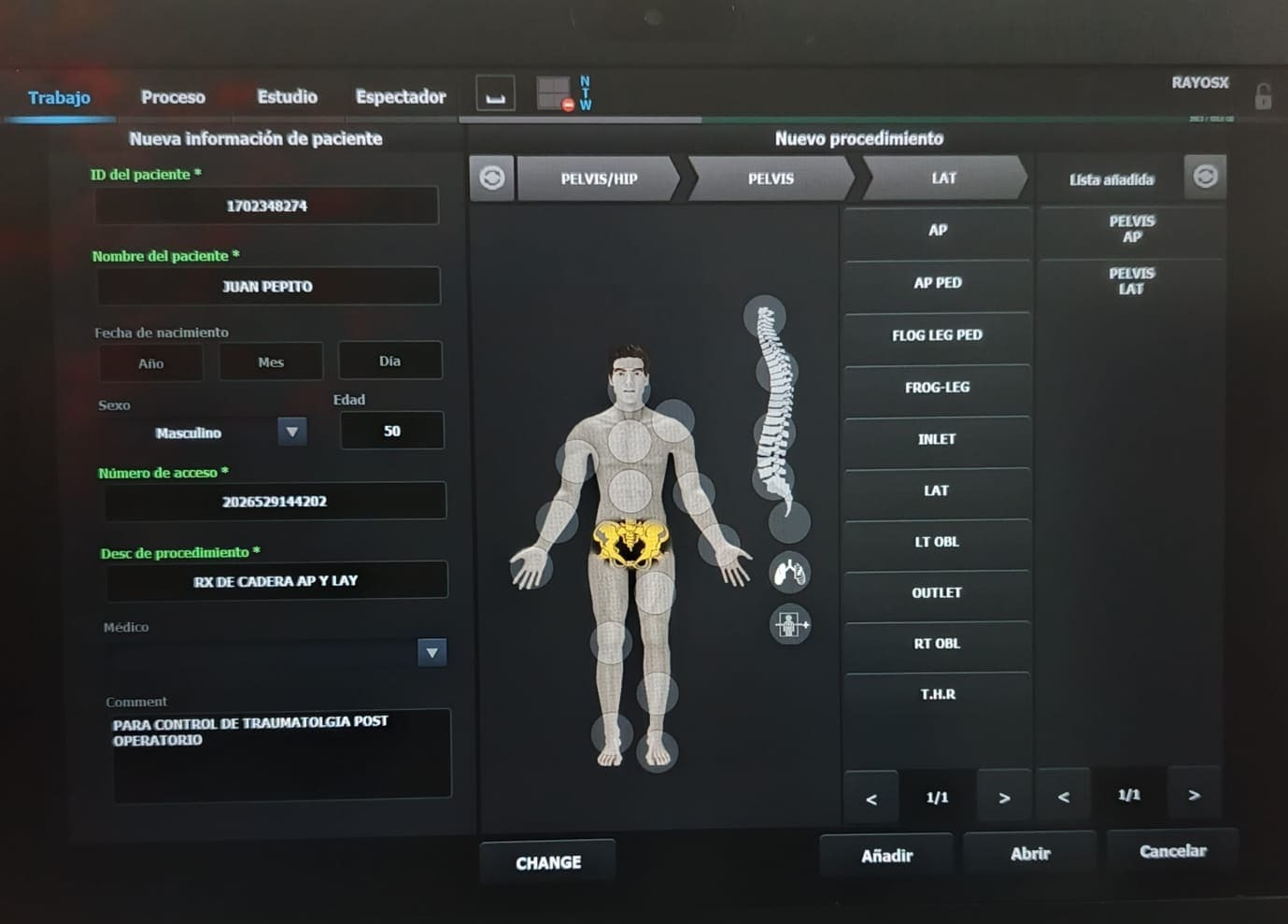 Estudios de rayos X de cuerpo completo