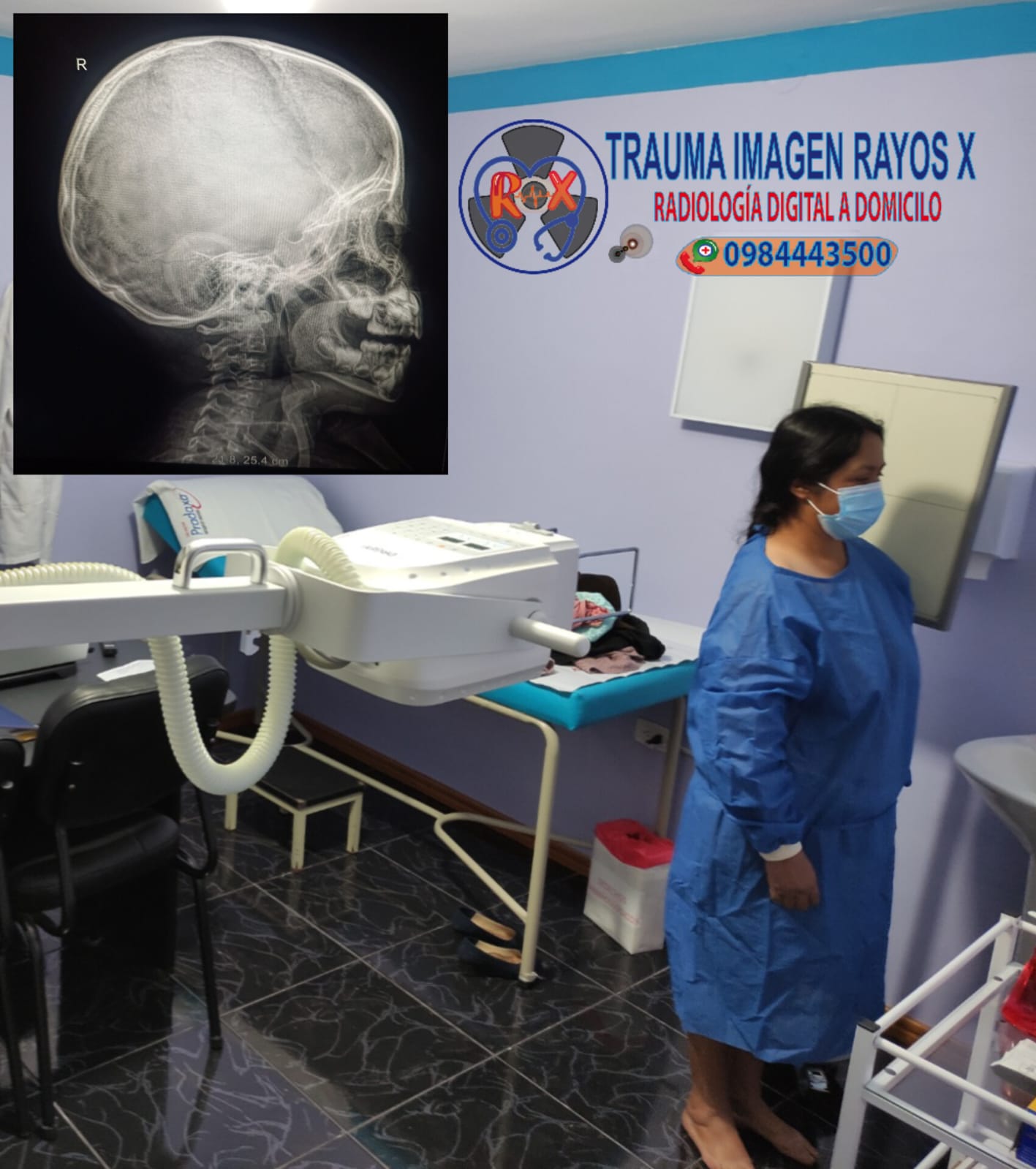 Estudio de cráneo lateral